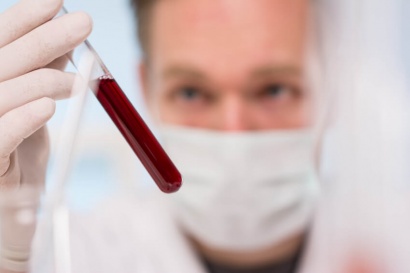 Hematofagia-2-analisis darah